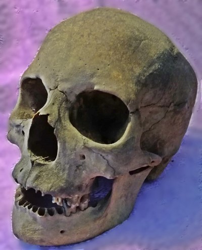 egizi medicina